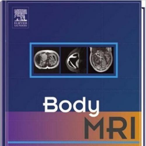 Body MRI by Evan Siegelman