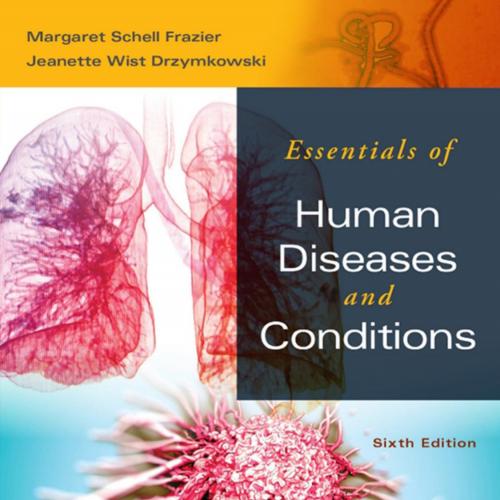 Essentials of Human Diseases and Conditions 6th Edition