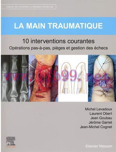 [AME]La main traumatique 10 interventions courantes: Manuel de chirurgie du membre supérieur (H...