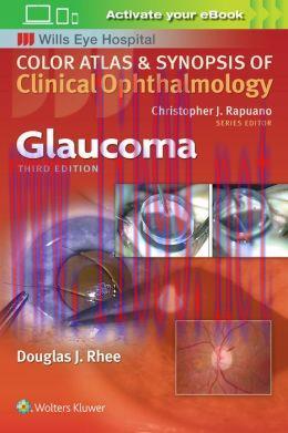[AME]Glaucoma (Color Atlas & Synopsis of Clinical Ophthalmology) (ePUB)