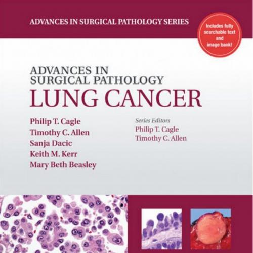 Advances in Surgical Pathology Lung Cancer