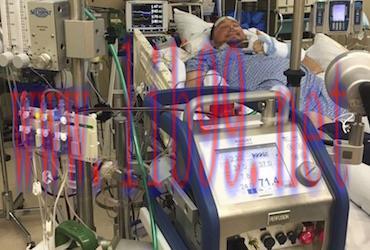 [AME]Adult ECLS Course – Innovative ECMO Concepts (Complete Contents)