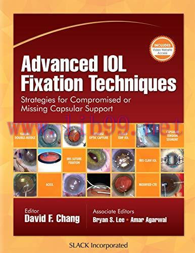 [AME]Advanced IOL Fixation Techniques: Strategies for Compromised or Missing Capsular Support (...