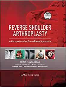 Reverse Shoulder Arthroplasty A Comprehensive Case-Based Approach