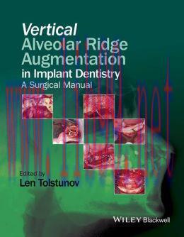[AME]Vertical Alveolar Ridge Augmentation in Implant Dentistry