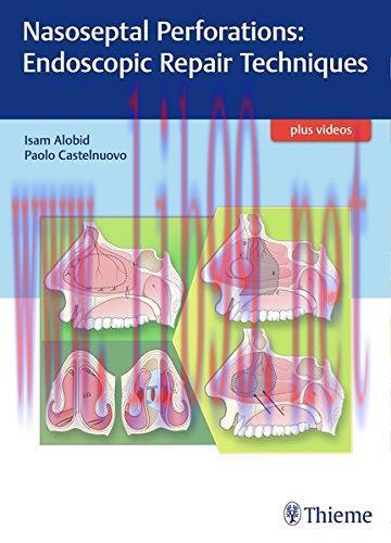 [AME]Nasoseptal Perforations: Endoscopic Repair Techniques (PDF)