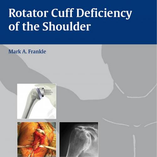 Rotator Cuff Deficiency of the Shoulder - Wei Zhi