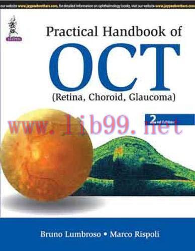 [AME]Practical Handbook of Oct Retina, Choroid, Glaucoma, 2nd Edition (Original PDF)
