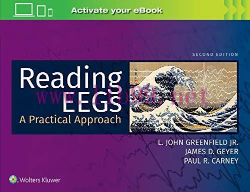 [AME]Reading EEGs: A Practical Approach, 2nd Edition (Original PDF)