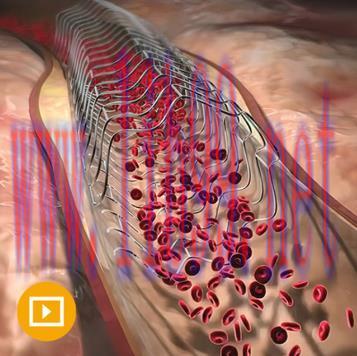 [AME]Comprehensive Review of Interventional Cardiology 2023 (CME VIDEOS)