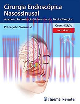 [AME]Cirurgia Endoscópica Nasossinusal: Anatomia, Reconstrução Tridimensional e Técnica Cirúrgi...