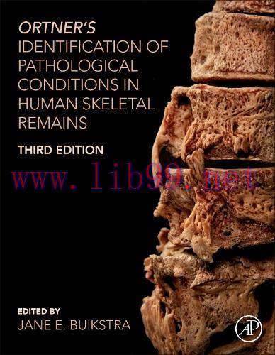 [AME]Ortner’s Identification of Pathological Conditions in Human Skeletal Remains, 3rd Edition