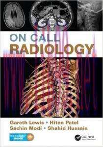 [AME]On Call Radiology