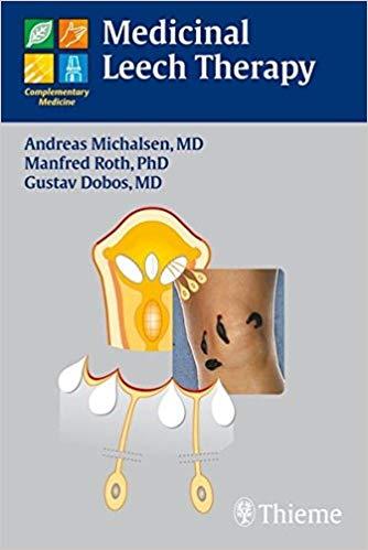 Medicinal Leech Therapy