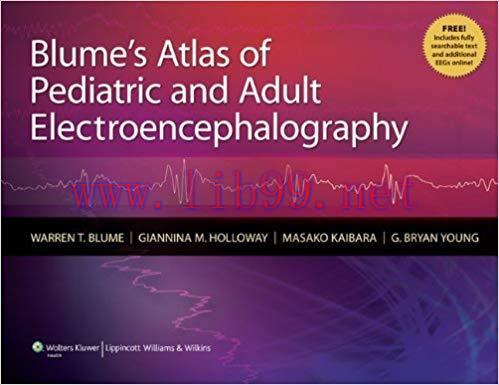 [PDF]Blume’s Atlas of Pediatric and Adult Electroencephalography