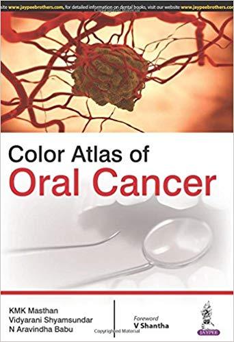 Color Atlas of Oral Cancer
