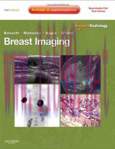 [AME]Breast Imaging: Expert Radiology series (Original PDF)