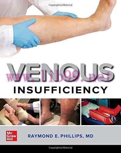 [AME]Venous Insufficiency (EPUB)