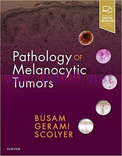 [PDF]Pathology of Melanocytic Tumors