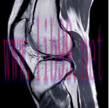 [AME]UCSF Neuro and Musculoskeletal Imaging 2022 (CME VIDEOS)