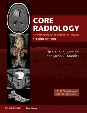 [PDF] Core Radiology A Visual Approach to Diagnostic Imaging 2nd Edition