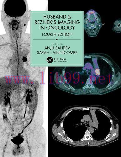 [AME]Husband & Reznek's Imaging in Oncology, 4th edition (ePub)