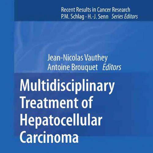 Multidisciplinary Treatment of Hepatocellular Carcinoma