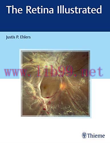 [PDF]The Retina Illustrated