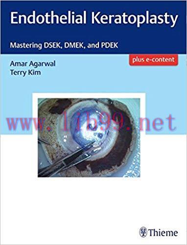[PDF]Endothelial Keratoplasty: Mastering DSEK, DMEK, and PDEK + VIDEO