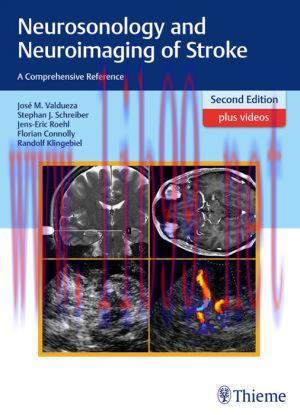 [AME]Neurosonology and Neuroimaging of Stroke: A Comprehensive Reference, 2nd Edition (EPUB)