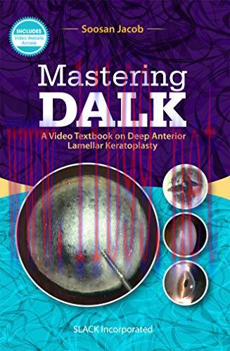[AME]Mastering DALK: A Video Textbook on Deep Anterior Lamellar Keratoplasty (PDF)
