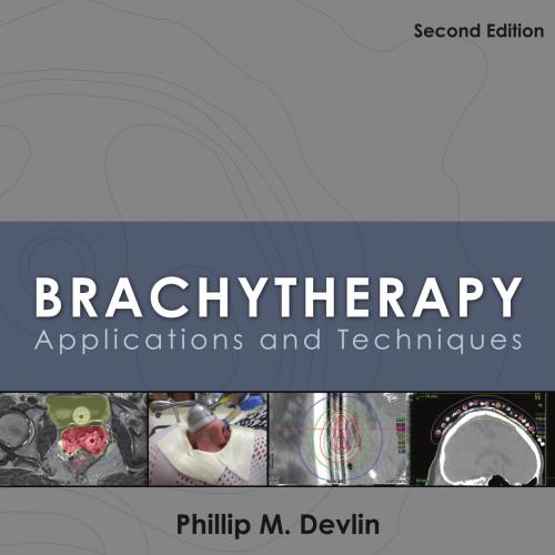 Brachytherapy_ Applications and Techniques, Second Edition