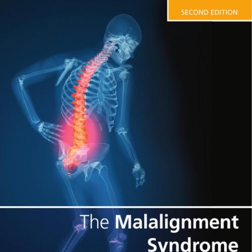 Malalignment Syndrome Implications for Medicine and Sport 2nd Edition, The