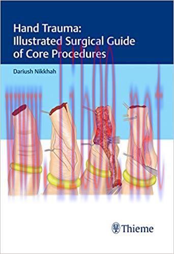 (PDF)Hand Trauma: Illustrated Surgical Guide of Core Procedures 1st Edition