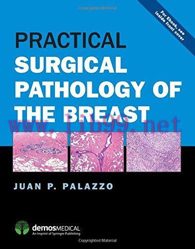 [AME]Practical Surgical Pathology of the Breast (PDF)