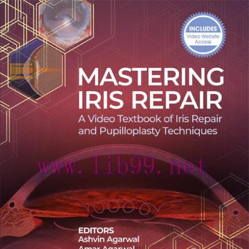 [AME]Mastering Iris Repair: A Video Textbook of Iris Repair and Pupilloplasty Techniques (EPUB)