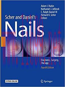 (PDF)Scher and Daniel’s Nails: Diagnosis, Surgery, Therapy 4th Edition
