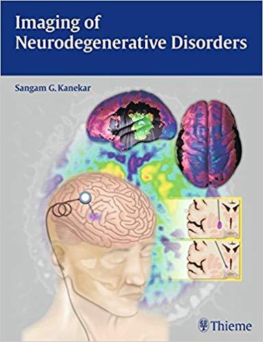 lmaging of Neurodegenerative Disorders