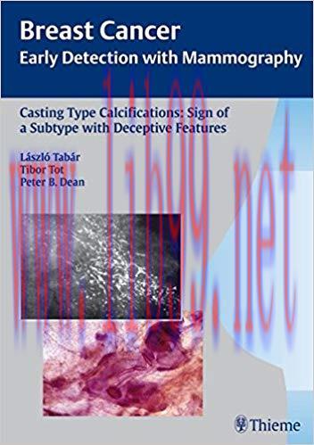 [PDF]Casting Type Calcifications (Rare)