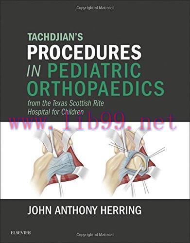 [AME]Tachdjian’s Procedures in Pediatric Orthopaedics: From_ the Texas Scottish Rite Hospital f...
