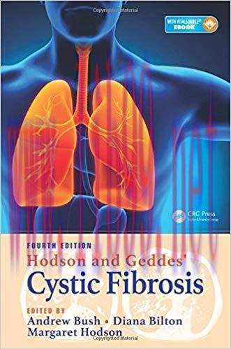 [PDF]Hodson and Geddes’ cystic fibrosis, 4E