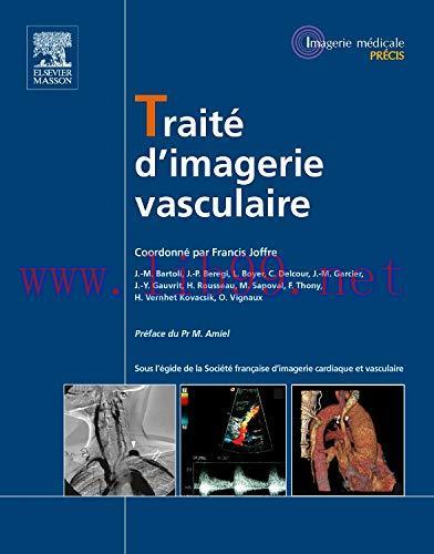 [AME]Traité d’imagerie Vasculaire (Imagerie médicale : Précis) (French Edition) (Original PDF)
