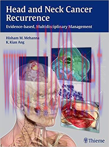 [PDF]Head and Neck Cancer Recurrence: Evidence-based, Multidisciplinary Management