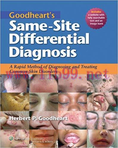 [PDF]Goodheart’s Same-Site Differential Diagnosis