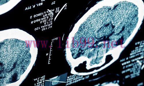 [AME]Stroke and Other Common Neurological Conditions 2019 (CME VIDEOS)