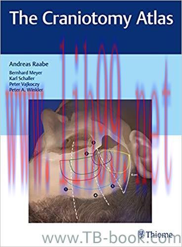 The Craniotomy Atlas 1st Edition by Andreas Raabe