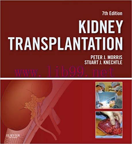 (PDF)Kidney Transplantation – Principles and Practice E-Book (Morris,Kidney Transplantation) 7t...