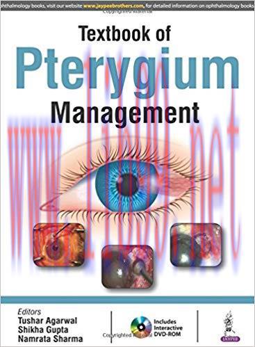 [PDF]Textbook of Pterygium Management