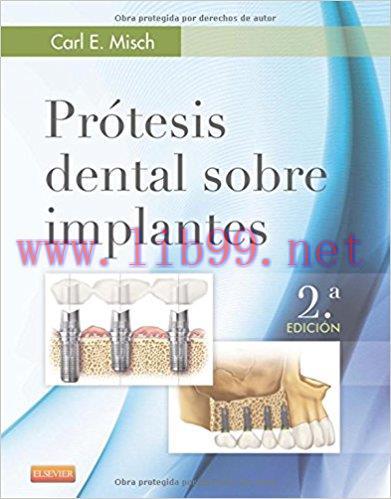 [AME]Prótesis dental sobre implantes (Spanish Edition), 2e (PDF)