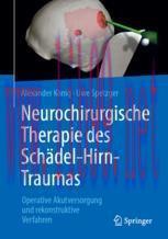 [PDF]Neurochirurgische Therapie des Schädel-Hirn-Traumas: Operative Akutversorgung und rekonstr...